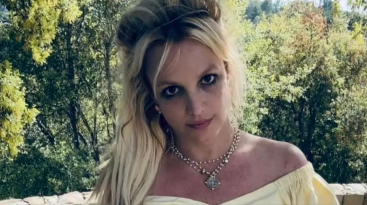 Britney Spears mostró las terribles quemaduras que sufrió durante un incendio en su casa