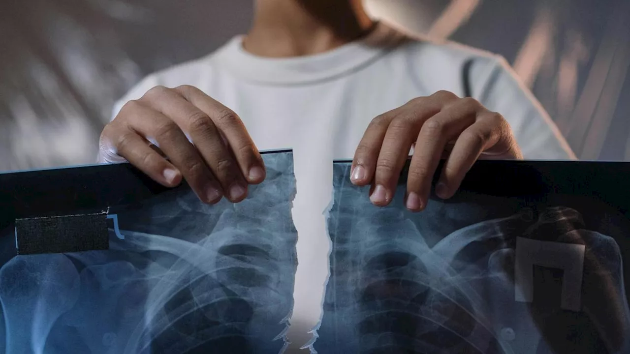 6 Tanda Awal Pneumonia, Peradangan Paru-Paru yang Harus Diwaspadai