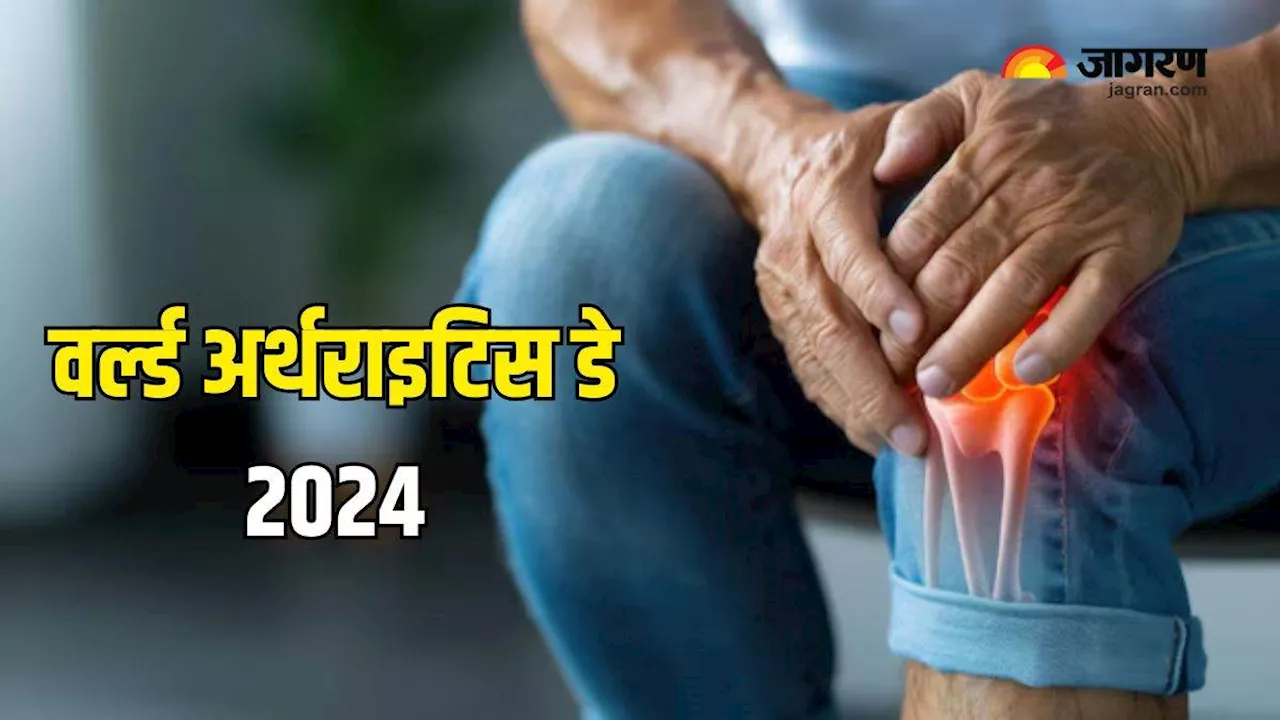 World Arthritis Day 2024: सिर्फ जोड़ों का दर्द ही नहीं, दिल की बीमारी का कारण भी बन सकता है गठिया, ऐसे करें बचाव