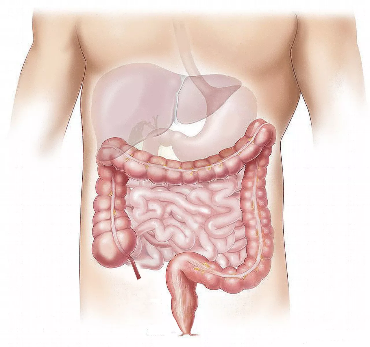 Chronic stress accelerates colorectal cancer progression by disrupting the balance of gut microbiota, study shows