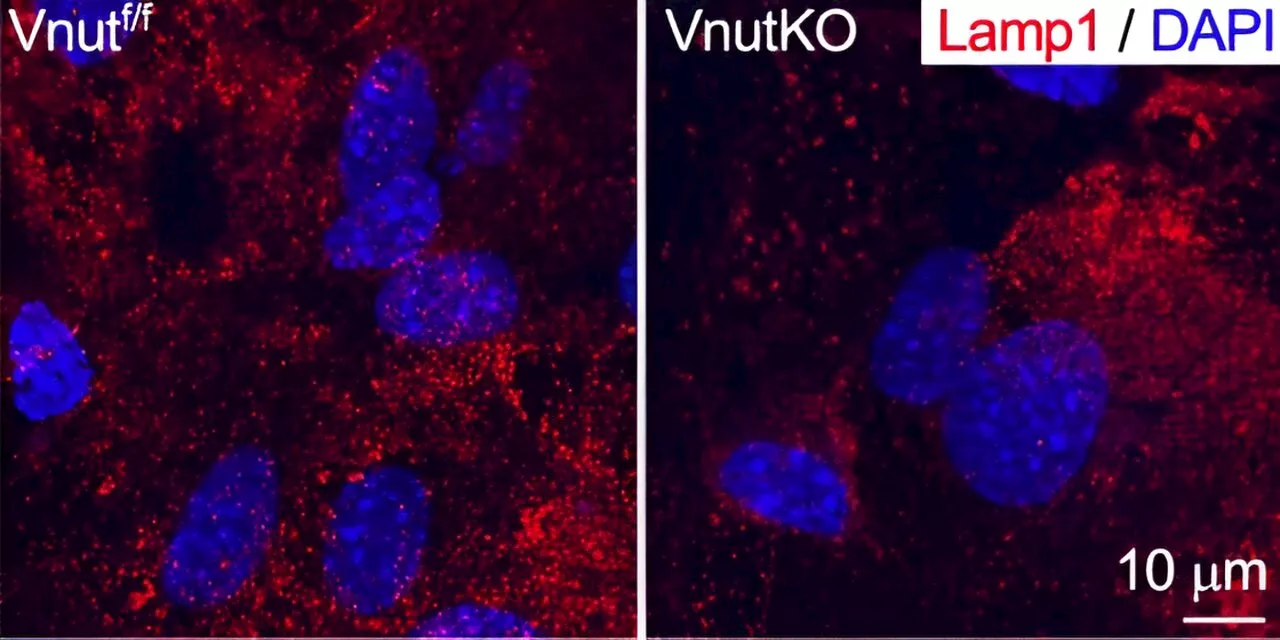 Study shows key brain protein can impact behavior in mice