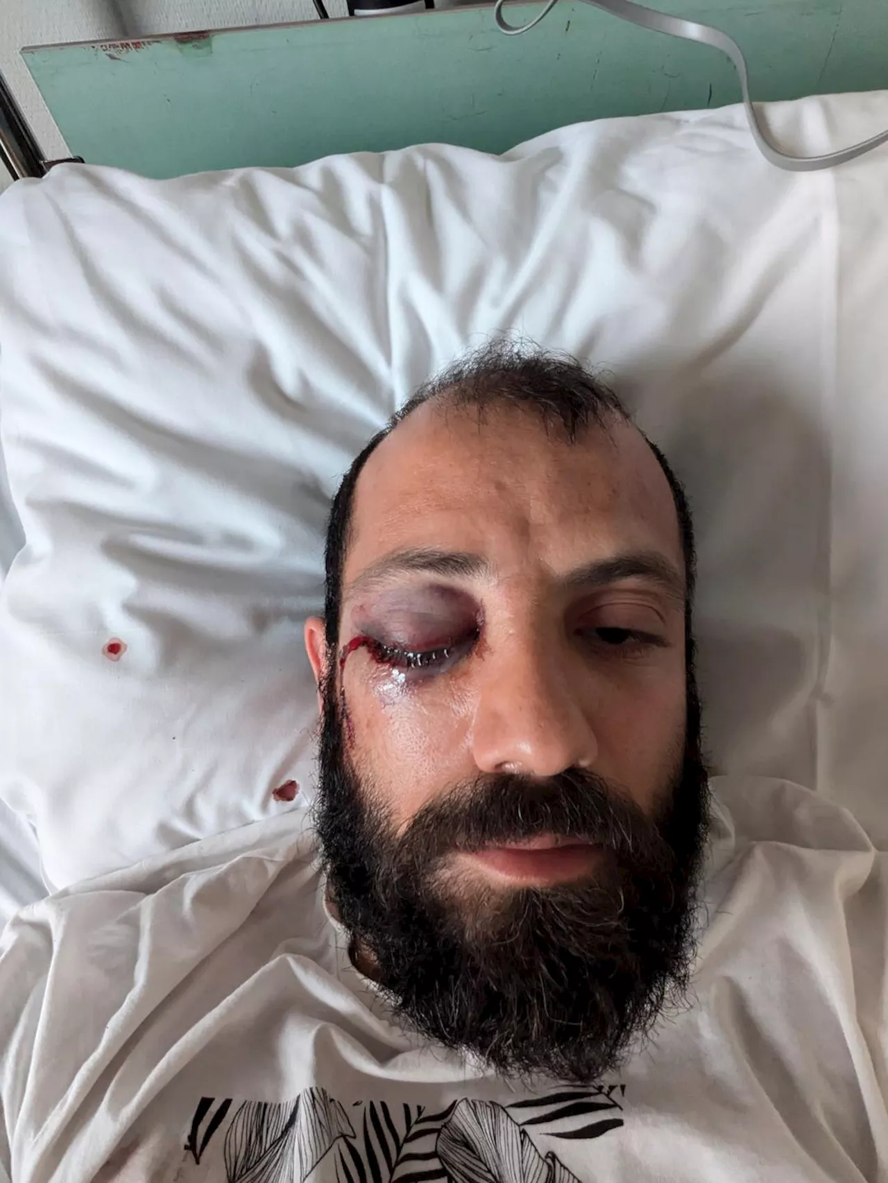 Ingen siktet etter voldssak på lekeplass i Drammen