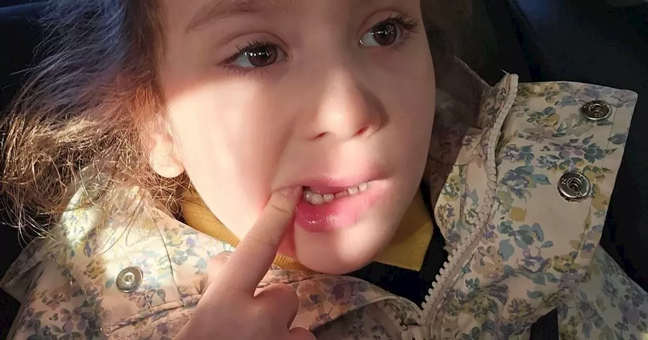 NI dad hits out as child with autism forced to wait a year for tooth removal