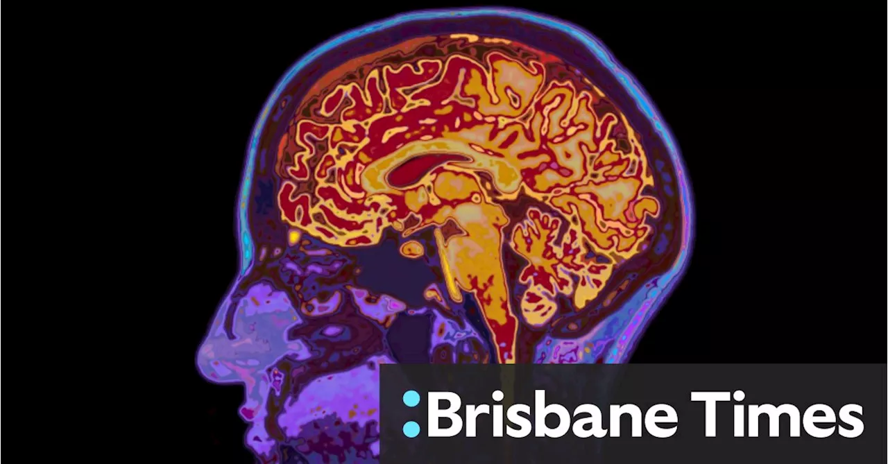 Brain Size Differences Between Conservatives and Liberals Found To Be Much Smaller Than Thought