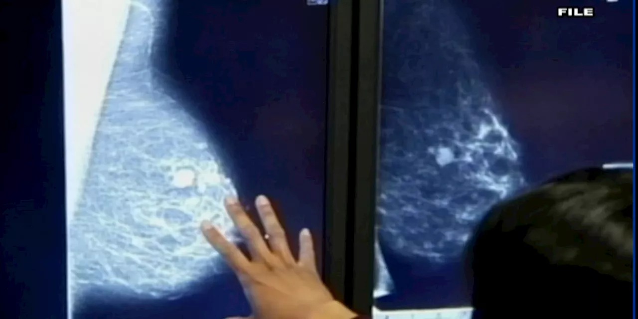 Health Report: Breast density linked to cancer risk, study shows