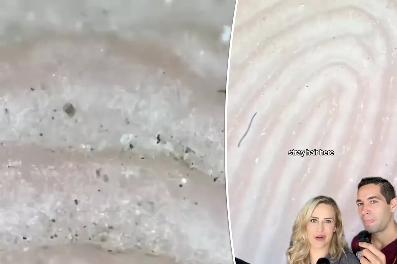 Doctors shocked by what they see on clean hands under a microscope: 'Oh, that is nasty'