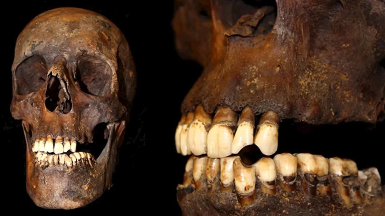 Shocking images reveal what smoking does to your BONES as scientists discover cigarettes change...