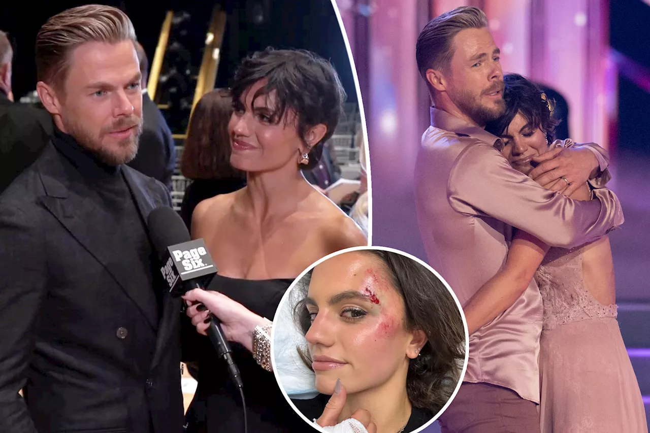  Derek Hough, Hayley Erbert reflect on her tear-filled return to ‘Dancing With the Stars’ nearly 1 year after emergency brain surgery