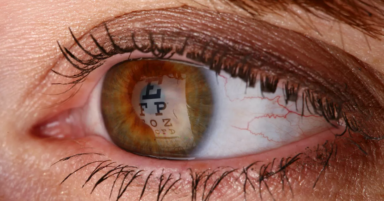 Is LASIK Safe? 2 Ophthalmologists Weigh In.