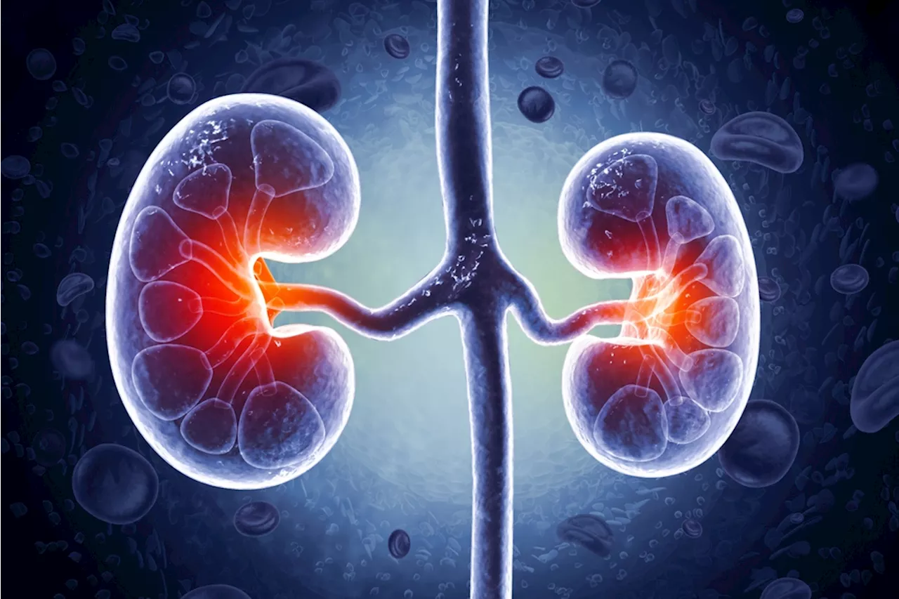 Over 800 Million People Have Chronic Kidney Disease but Many Don’t Know It