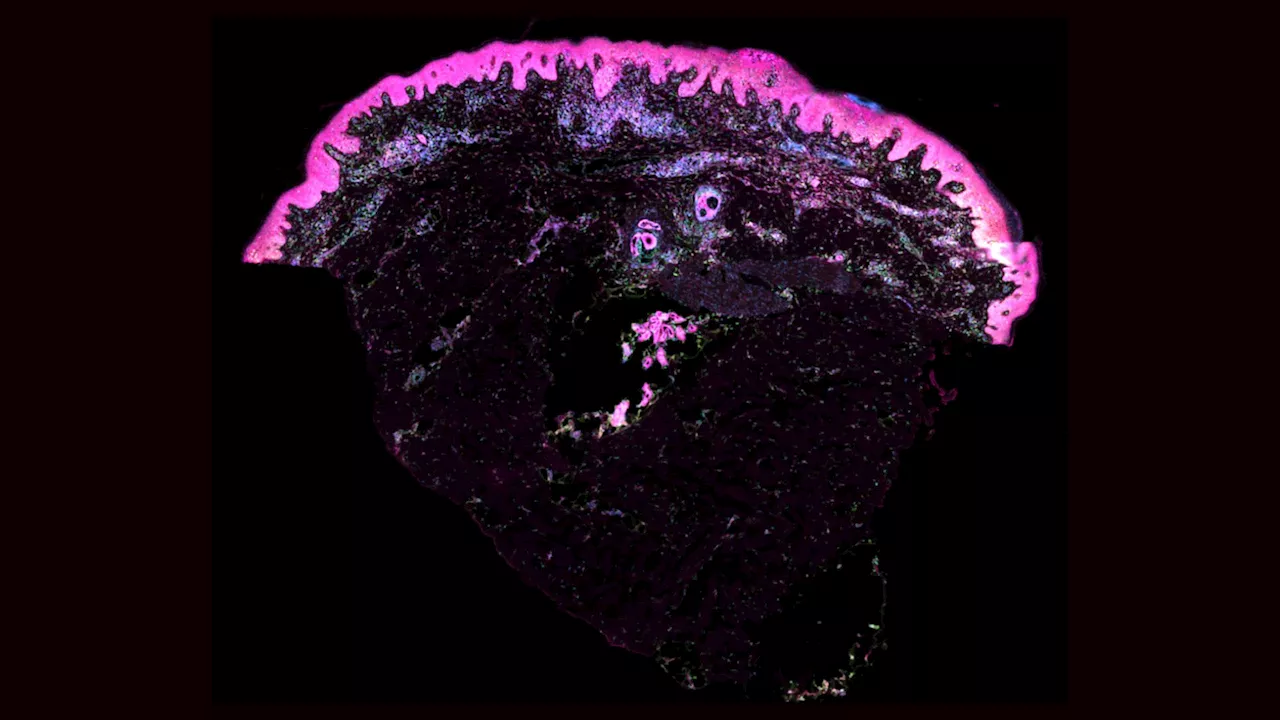 Scientists Create First-Ever Atlas of Human Skin Development Before Birth