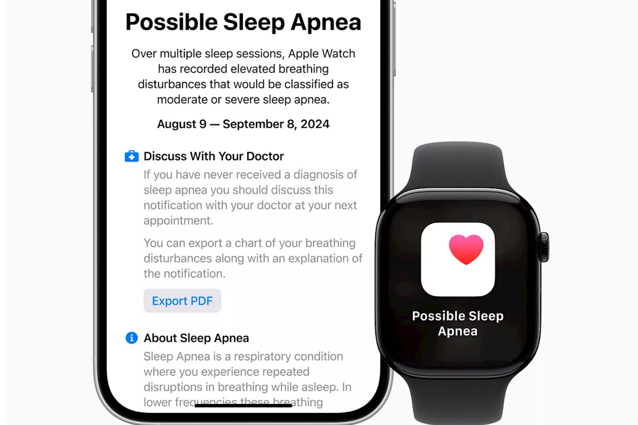 Votre Apple Watch prédit l’avenir de votre santé ?