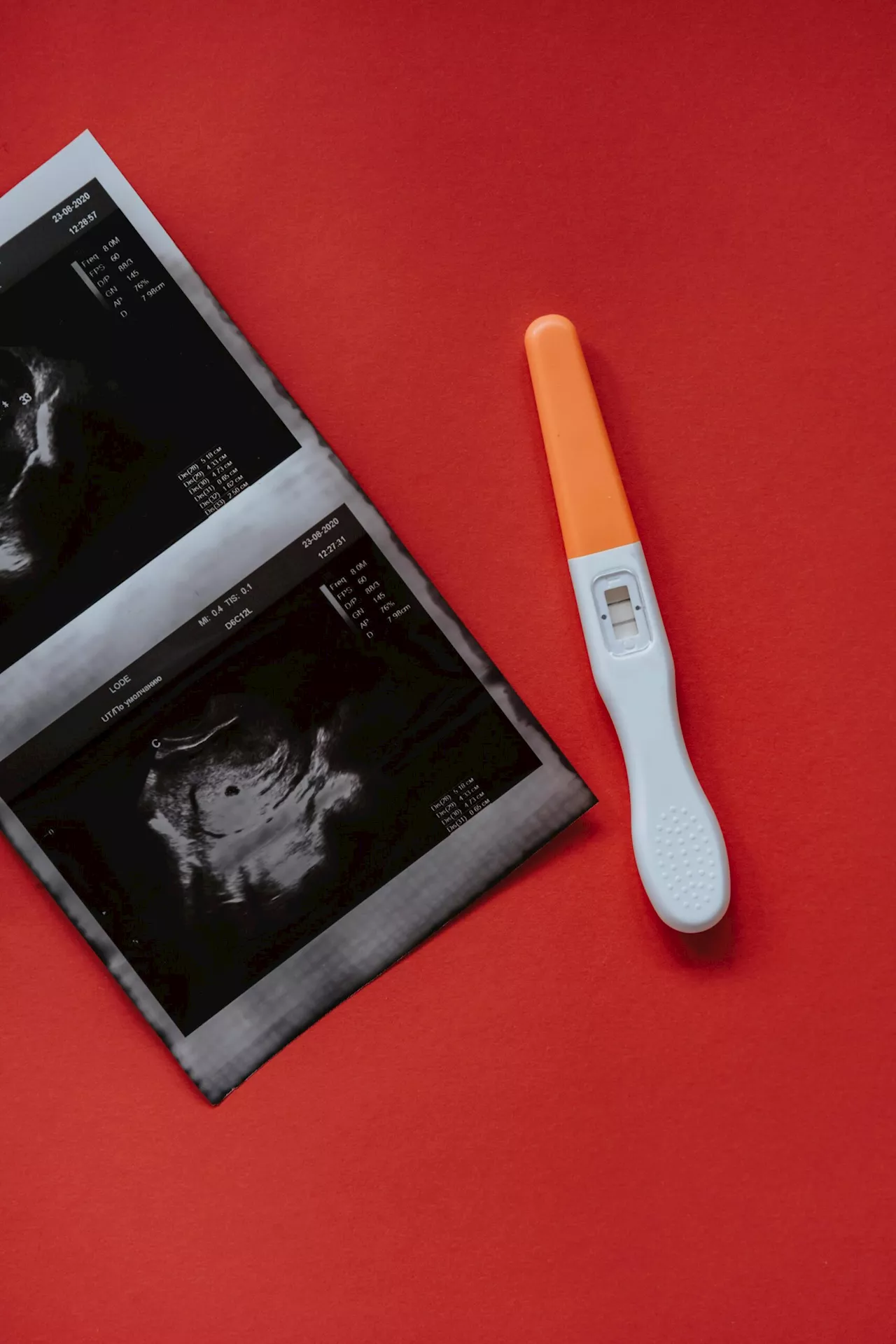 Boosting reproductive health efforts against unintended pregnancies