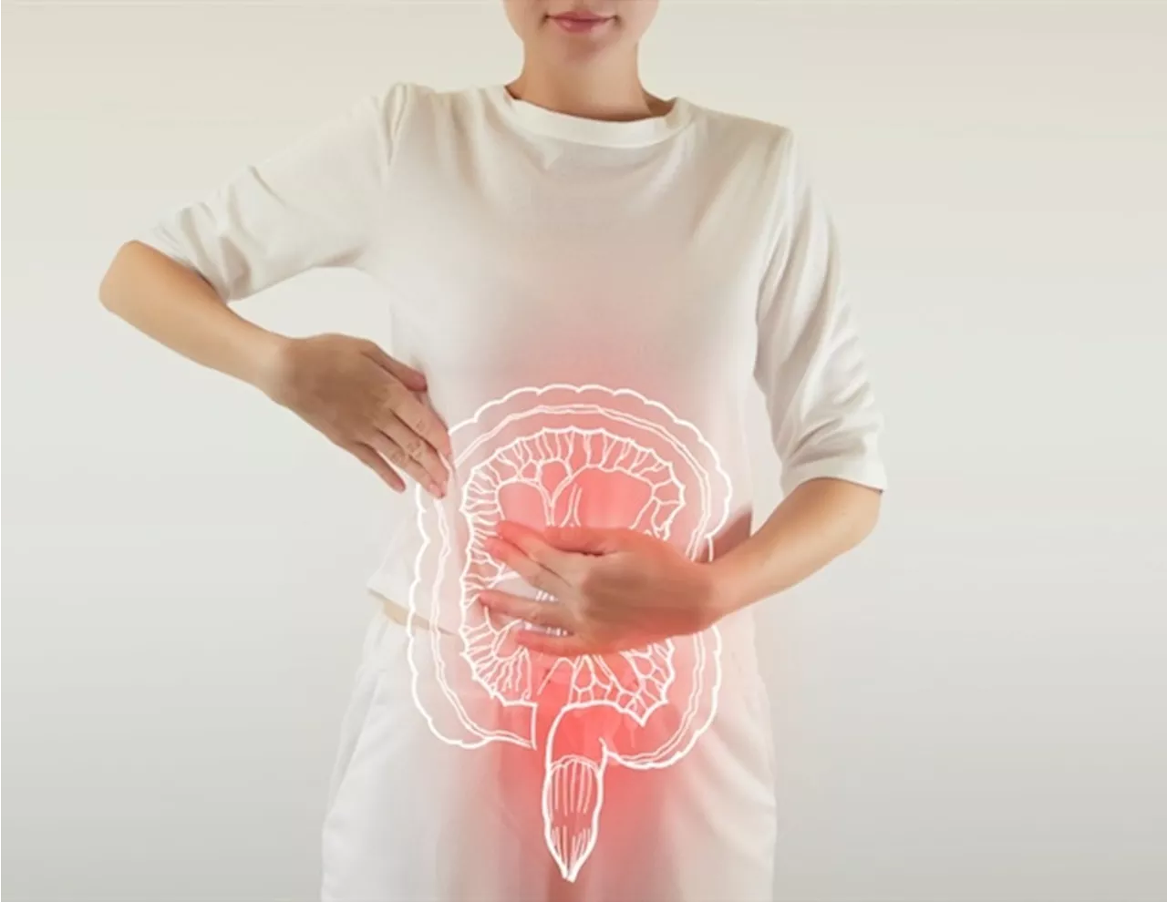 New genetic variant may predict severe ulcerative colitis in patients