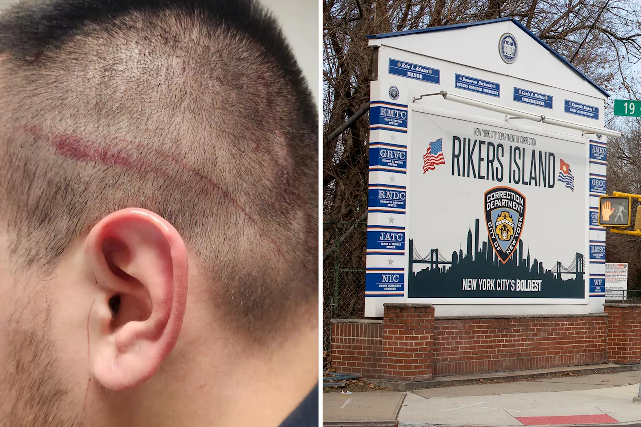 NYC correction officers union calls for Rikers security chief to be fired after another slashing attack