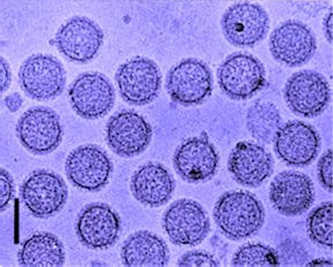 Febbre Oropouche, timori per trasmissione per via sessuale