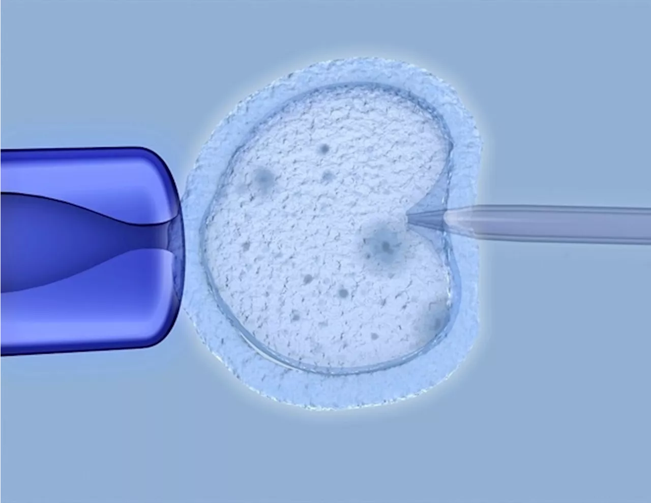 Study suggests chain fertility clinics improve IVF outcomes