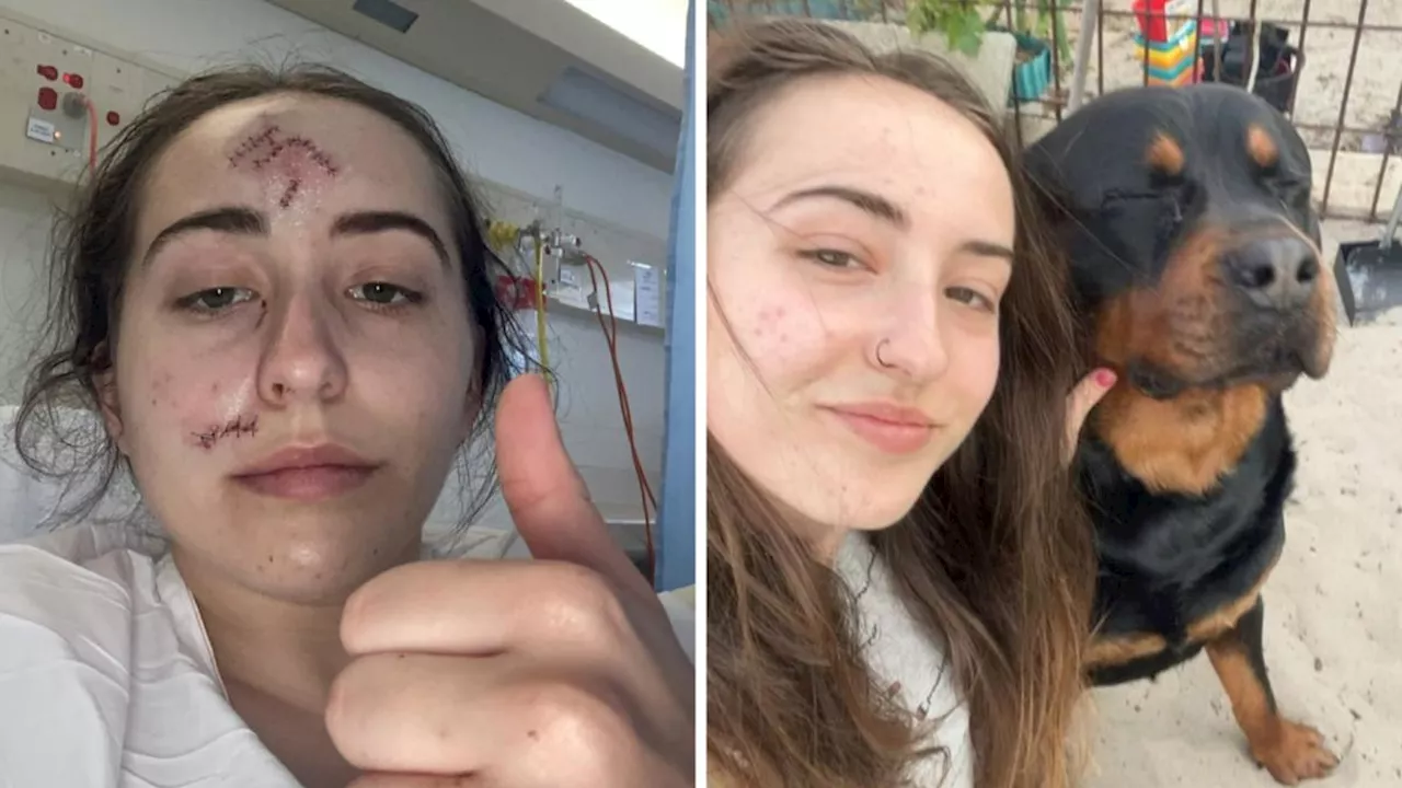 Dog attack: Perth woman Haylee Owens mauled by friend’s dog shares important warning