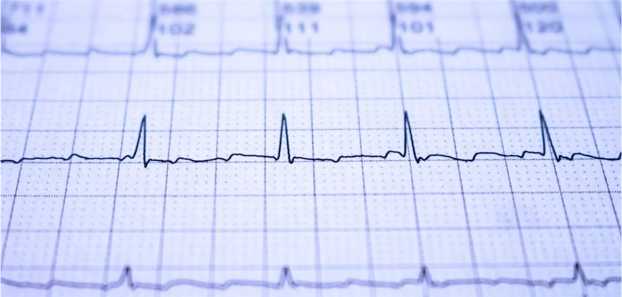 Antikoagulation : Taugen Risikoscores für Schlaganfall und Blutungen auch bei Krebs-Patienten mit Vorhofflimmern?