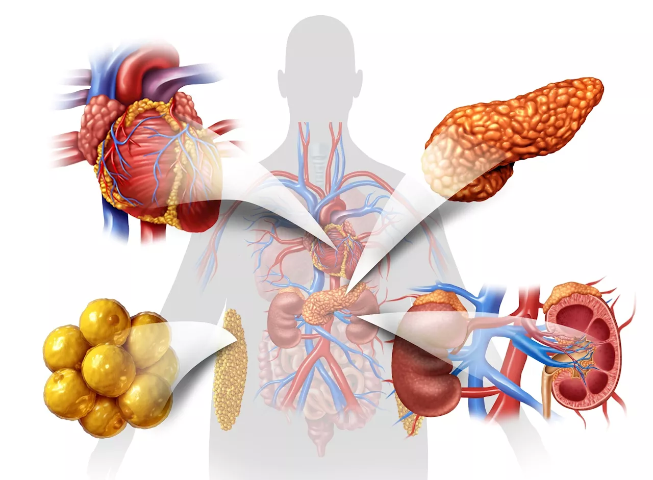 Genetic study uncovers key drivers of metabolic syndrome with brain tissue links