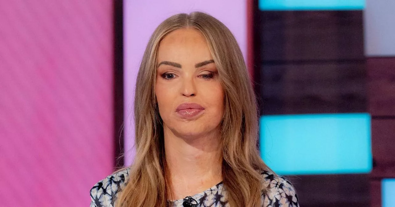 Katie Piper hits back at vile troll telling her to 'kill herself'