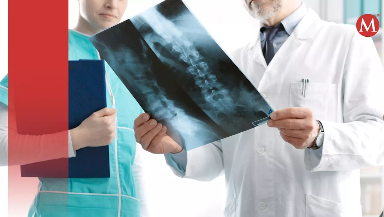 Especialistas de Tampico buscan concientizar sobre la osteoporosis