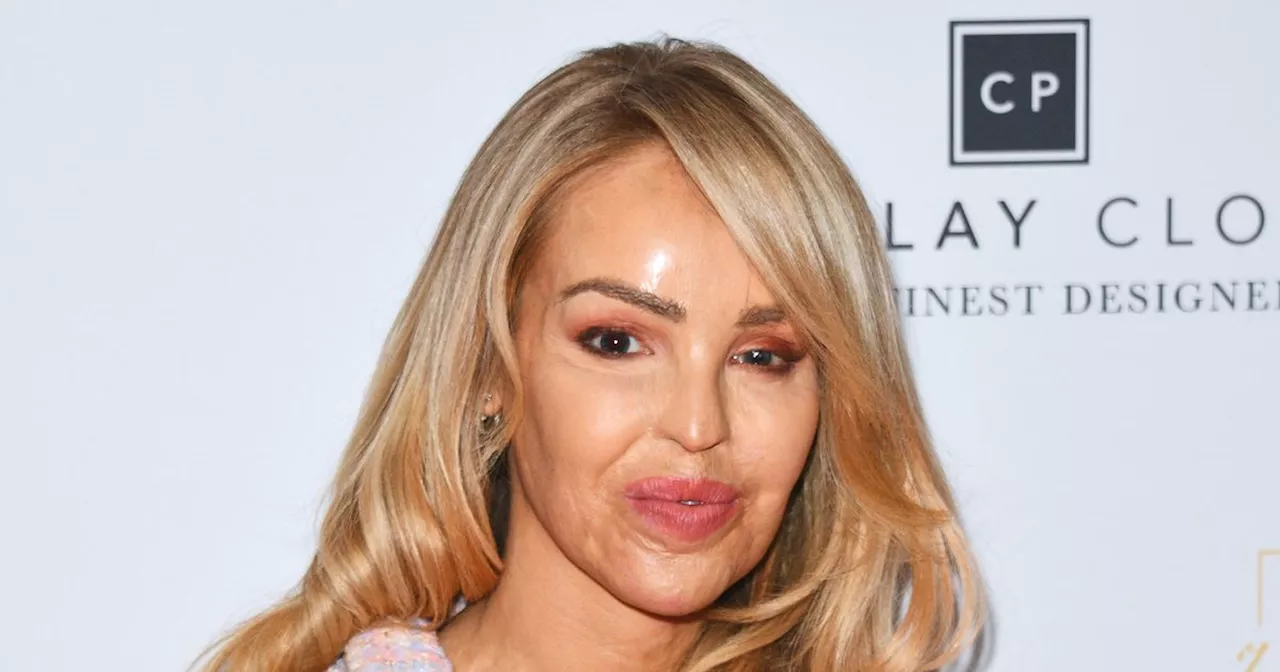 Katie Piper's heartache over vile trolling - 'this is not ok'