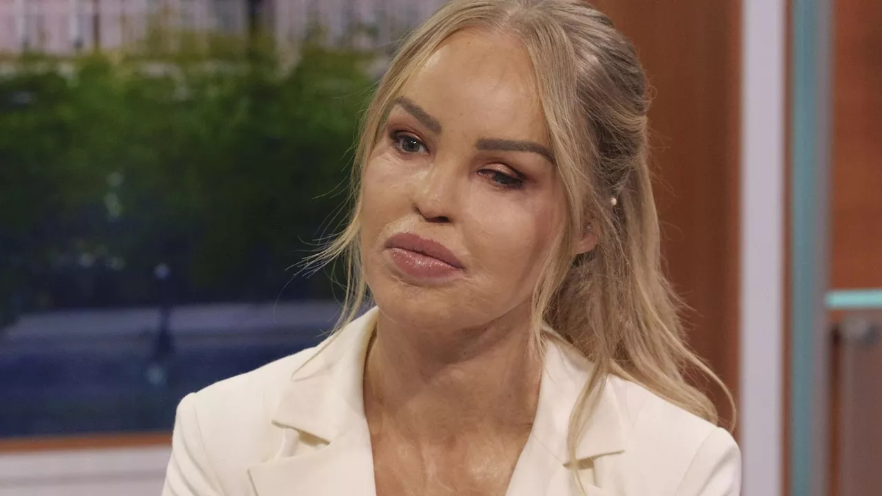 Katie Piper supported by ITV stars as she slams shocking message from troll...