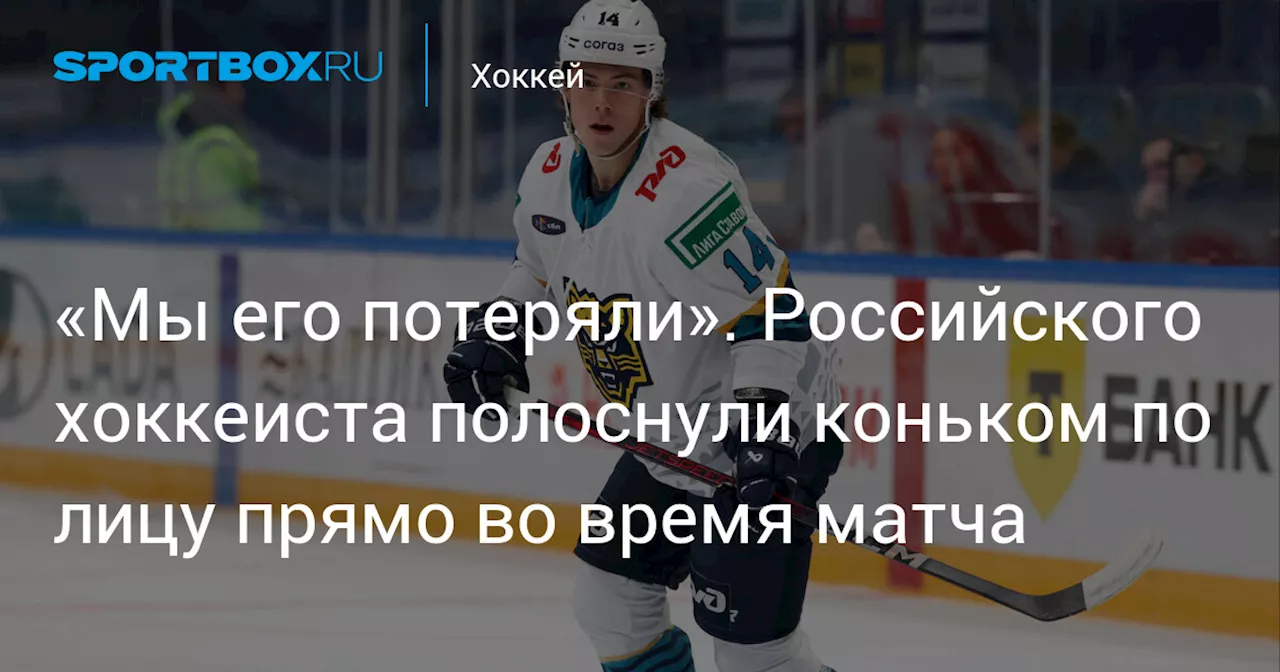 «Мы его потеряли». Российского хоккеиста полоснули коньком по лицу прямо во время матча