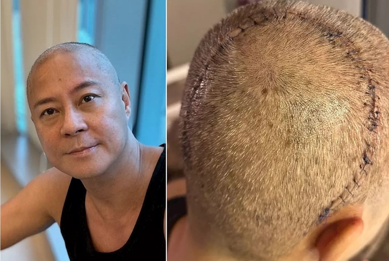 Cantopop trio Grasshopper’s Remus Choy reveals recent brain surgery