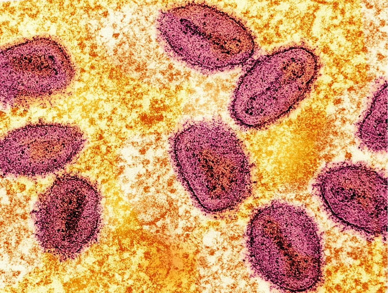 Germany identifies its first case of new mpox variant