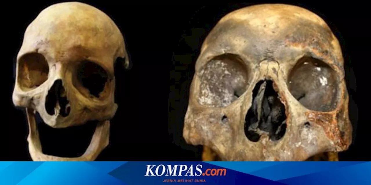 Arkeolog Temukan Efek Mengerikan Merokok di Tengkorak Abad ke-18