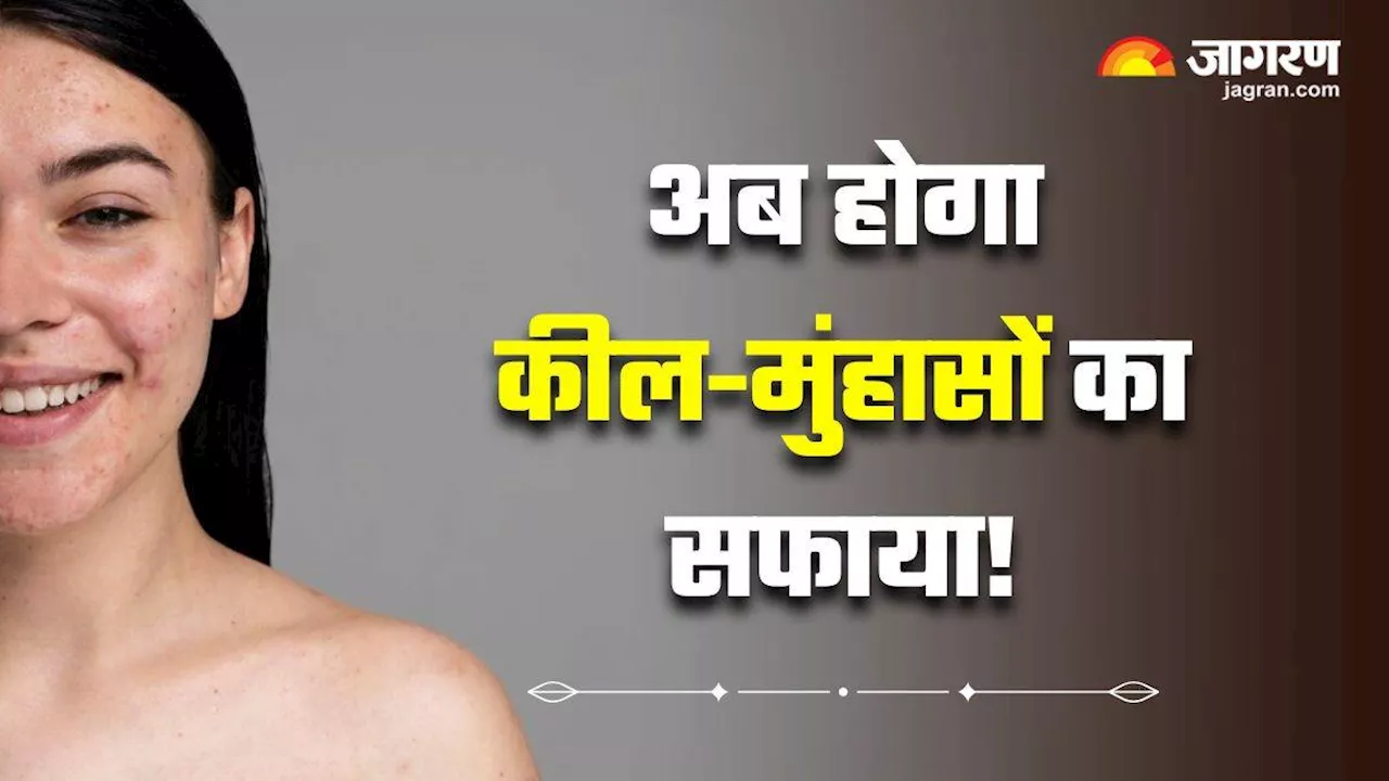 Skin Care Tips: कील-मुंहासों का रामबाण इलाज हैं आपके घर की रसोई में रखी 5 जादुई चीजें, बस ऐसे करें इस्तेमाल