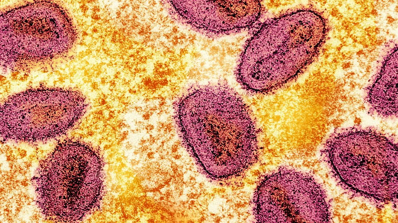 RKI: Keine Gefährdung: Neue Mpox-Variante erstmals in Deutschland nachgewiesen