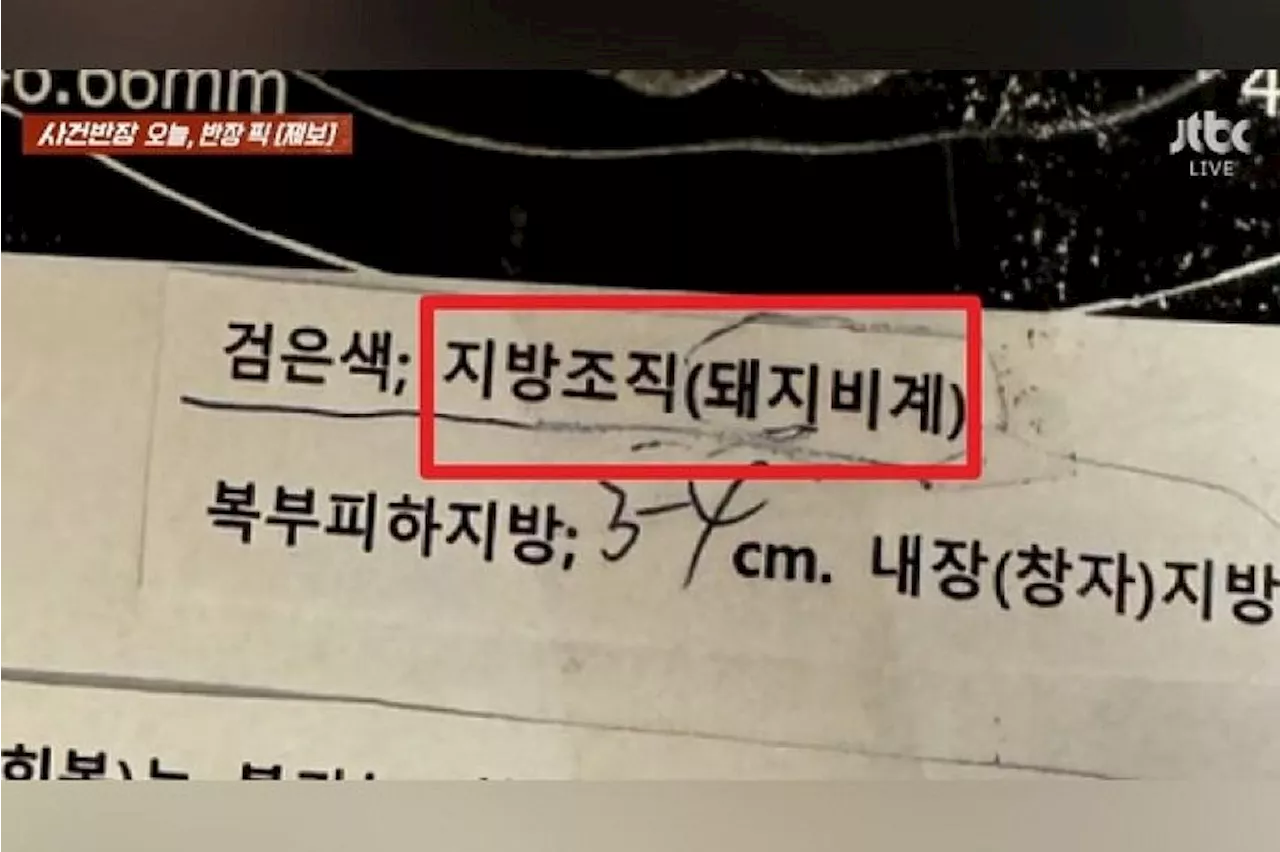 South Korean doctor under fire for labelling patient’s fat tissue as ‘lard’ in medical report