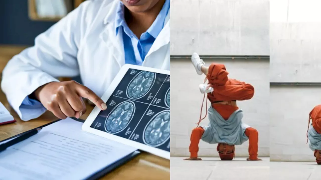 Hombre desarrolla un tumor de 30 centímetros en el cuero cabelludo tras décadas de practicar breakdance