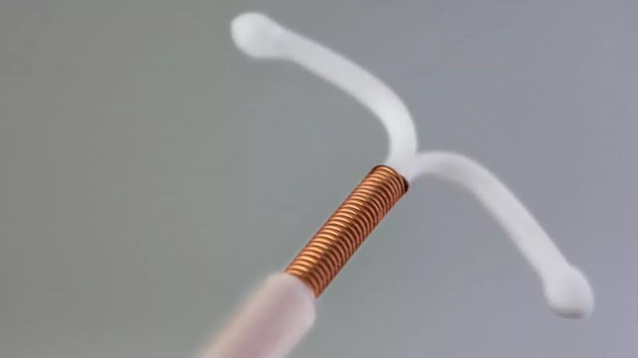 Mepivacaine Reduces Pain During IUD Placement in Nulliparous Women