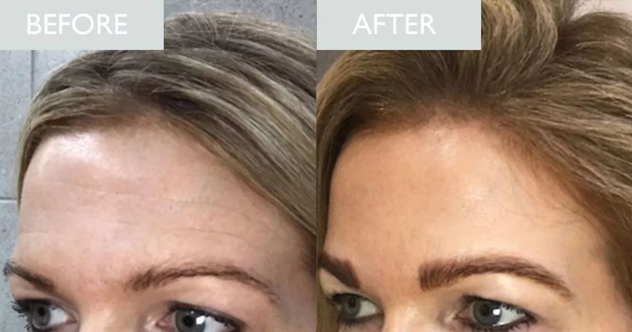 'After one use of this balm I noticed a huge difference in my forehead lines'