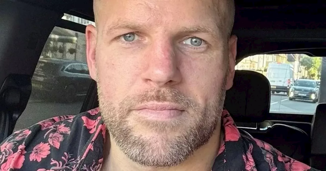 James Haskell updates fans with results of hair transplant in new snap
