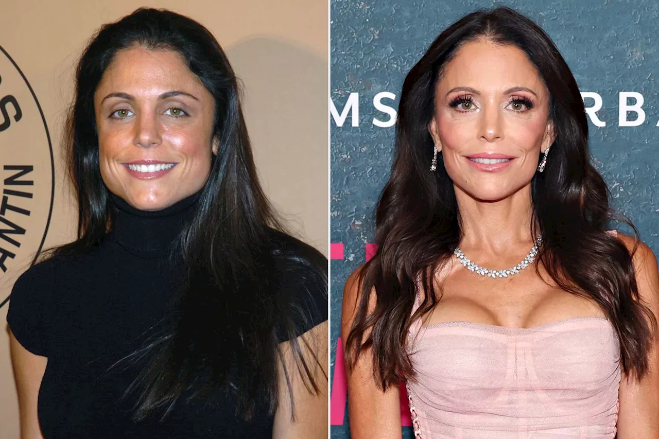 Bethenny Frankel Slams 'Haters' Who Are Upset She 'Looks Better' Than 20 Years Ago: 'I Hadn't Found Jaw Botox'