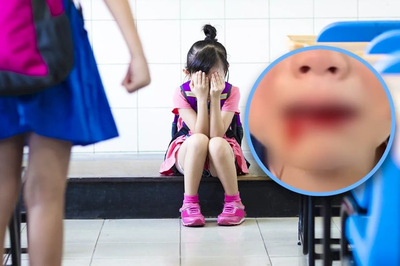 China dad criticised for not holding school bullies accountable after daughter bled from mouth