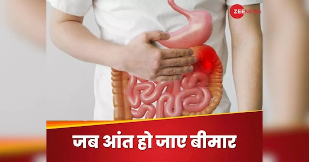 Unhealthy Gut: आंतों में खराबी आने पर शरीर में दिखते हैं ऐसे लक्षण, इग्नोर करने से बढ़ेगी परेशानी