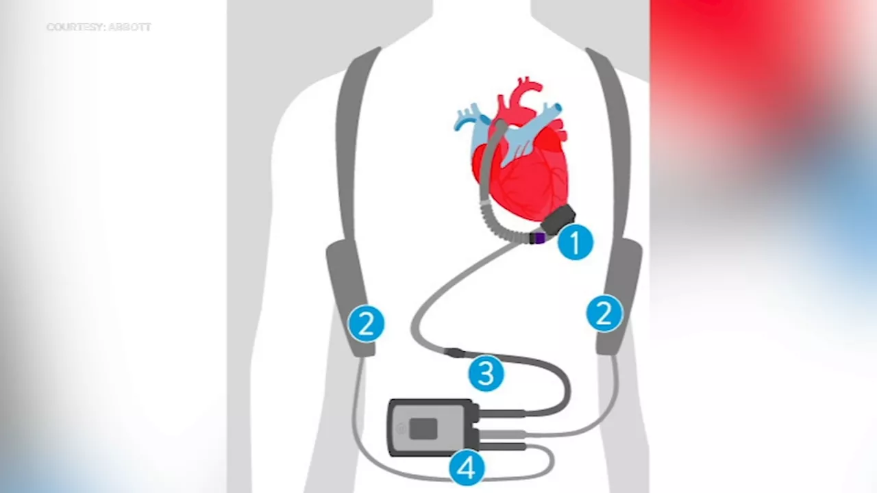 VAD heart pump helps keep Delaware heart failure patient on the go