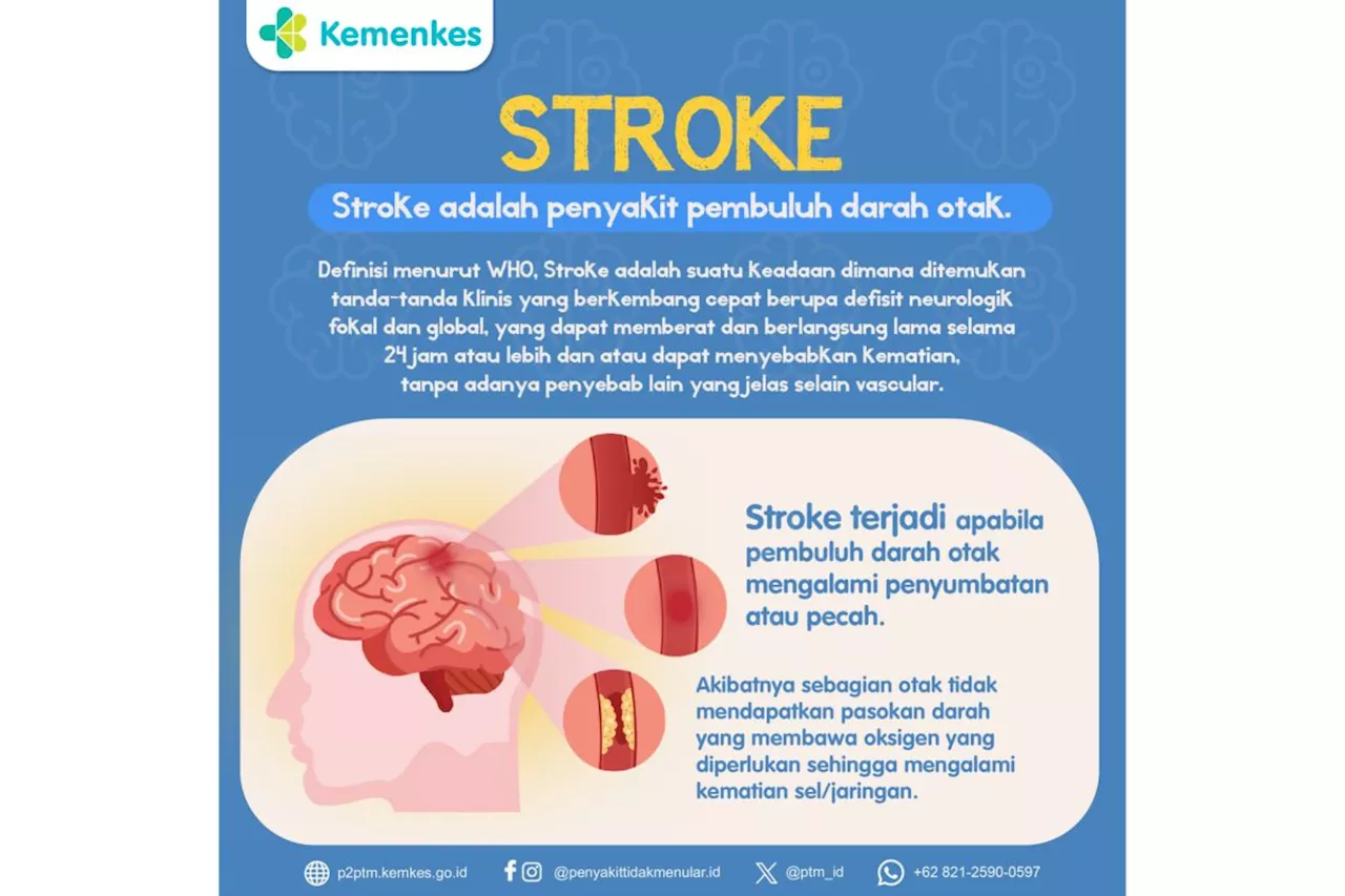 Stroke ringan bisa hilang 24 jam tapi tak bisa disepelekan