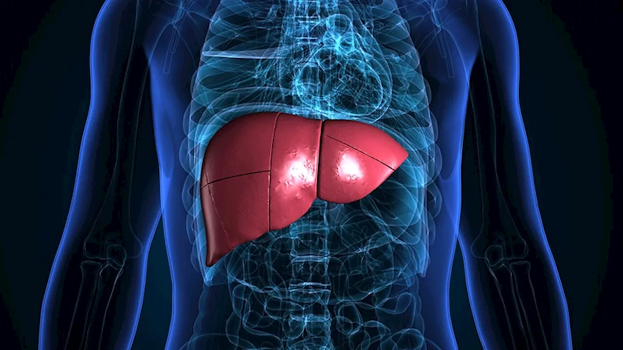 Can We Repurpose Obesity Drugs to Reverse Liver Disease?