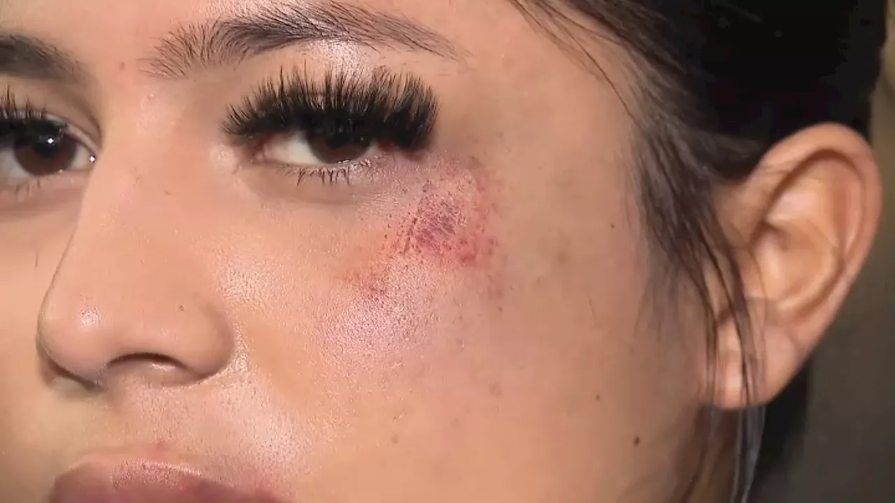 Cal State Dominguez Hills student says she was attacked by man on campus