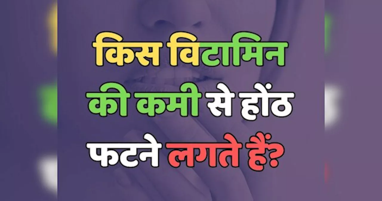 Trending Quiz : किस विटामिन की कमी से होंठ फटने लगते हैं?