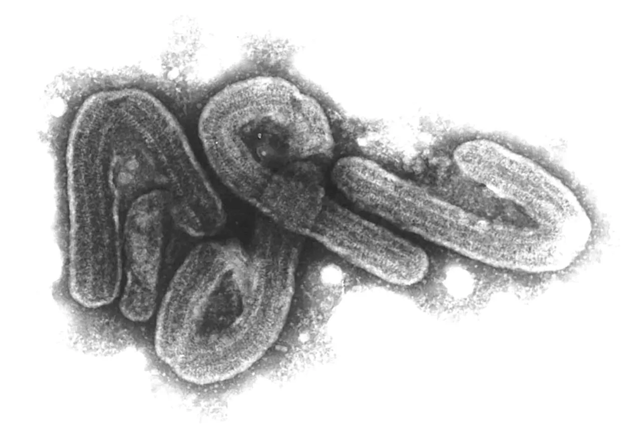 Marburg-Virus in Ruanda - Zahl der Infizierten steigt