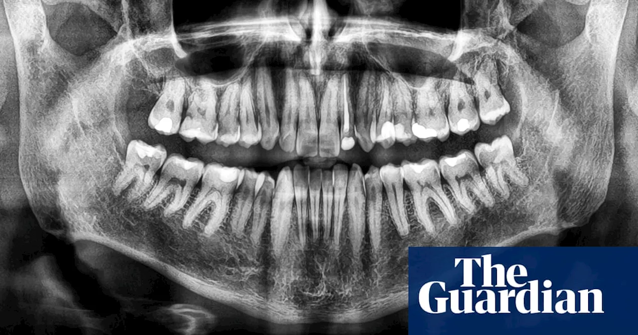 Tara lost her teeth ‘one by one’ and can barely eat. She’s not alone, an Australian dental study says