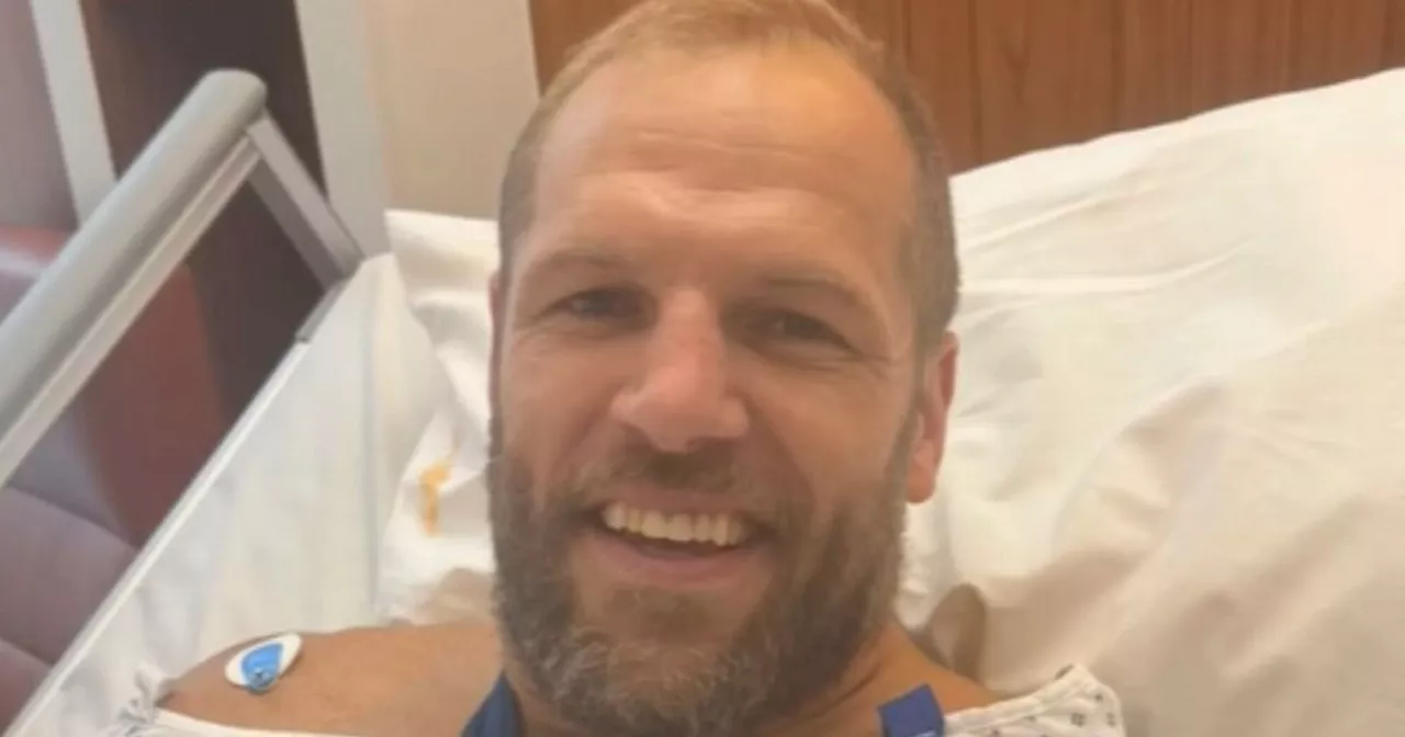 James Haskell shares gruesome extent of injury as arm 'snapped'